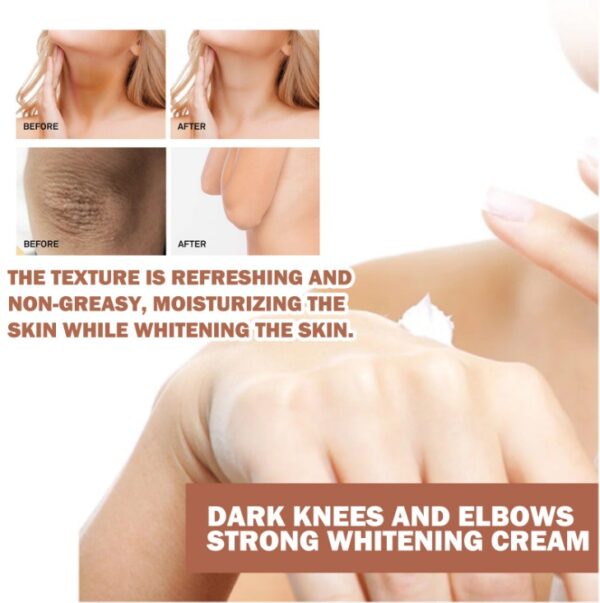 EELHOE Joint Darkening & Brightening Cream Moisturizing & Brightening Dark Skin Joint & Elbow Repair Cream - Image 2